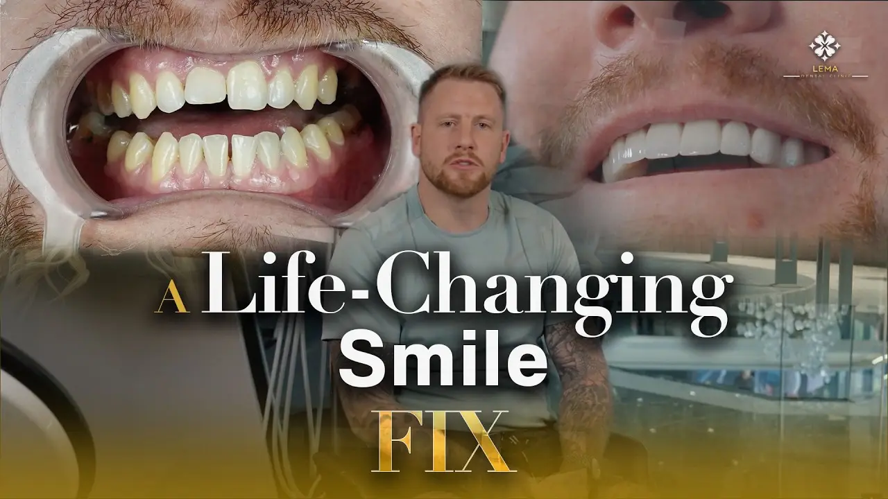 Fixing Dental Trauma | A Patient Success Story!