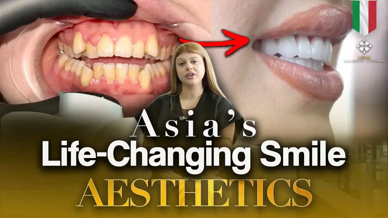 Asia’s Life-Changing Smile Aesthetics: From Italy to Istanbul!